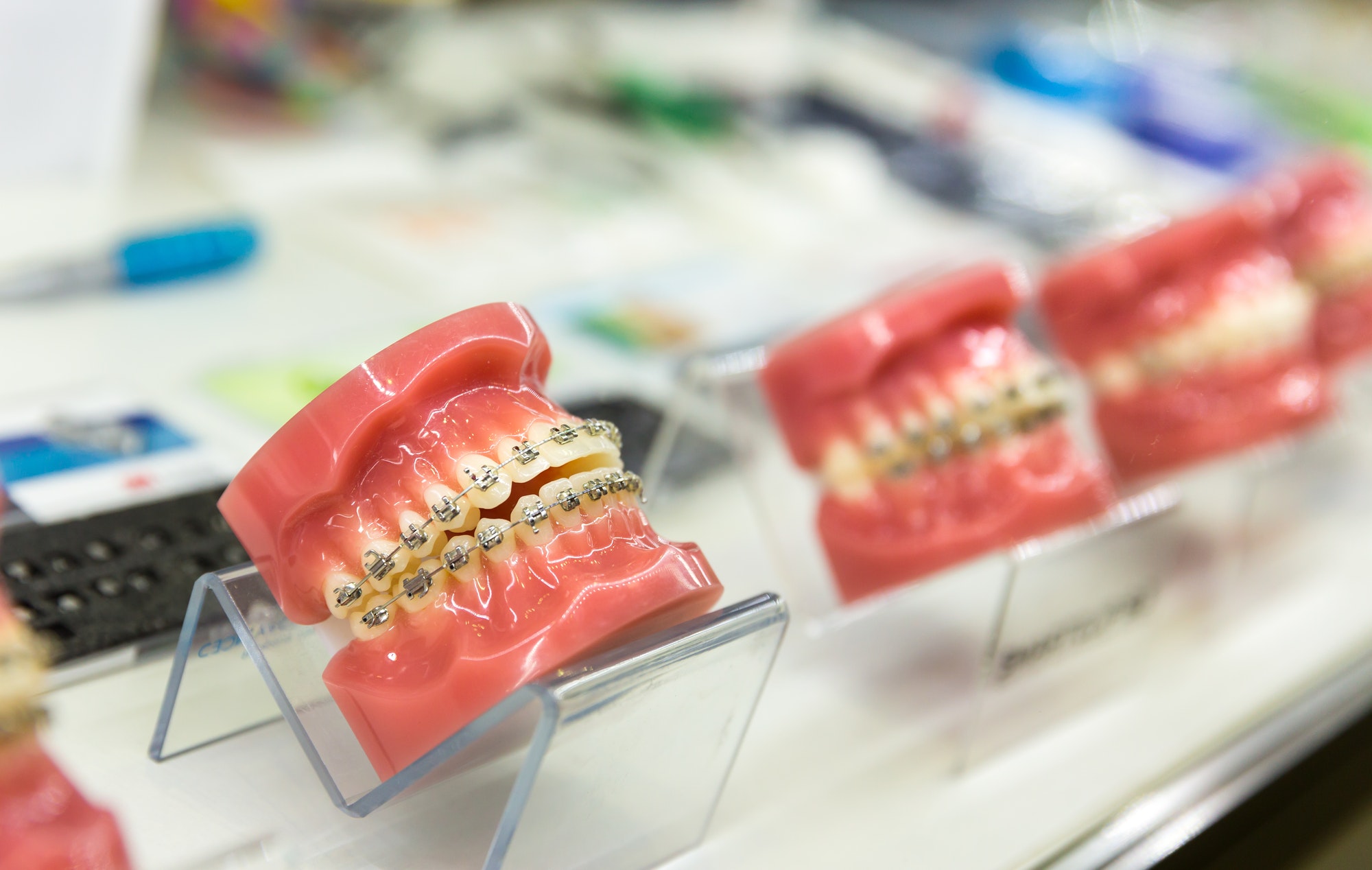 What Is Orthodontics And How Do I Know If I Need Orthodontics?