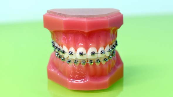 Complete And Partial Dentures In Gombak,